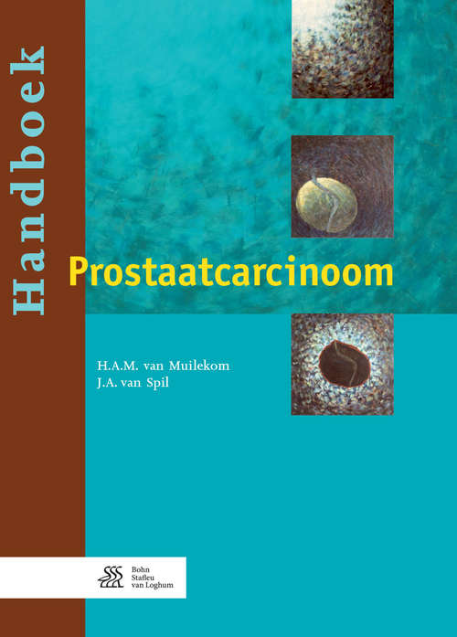 Book cover of Handboek prostaatcarcinoom