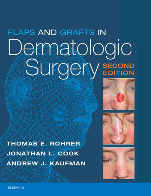 Book cover of Flaps and Grafts in Dermatologic Surgery E-Book (2)