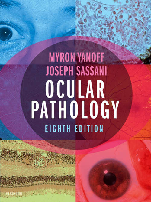 Book cover of Ocular Pathology E-Book: A Text And Atlas (5)