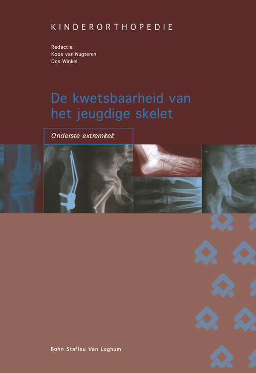 Book cover of De kwetsbaarheid van het jeugdige skelet: onderste extremiteit (2004) (Orthopedische casuïstiek)