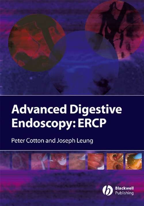 Book cover of Advanced Digestive Endoscopy: ERCP