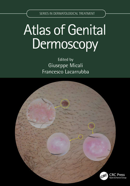 Book cover of Atlas of Genital Dermoscopy (Series in Dermatological Treatment)