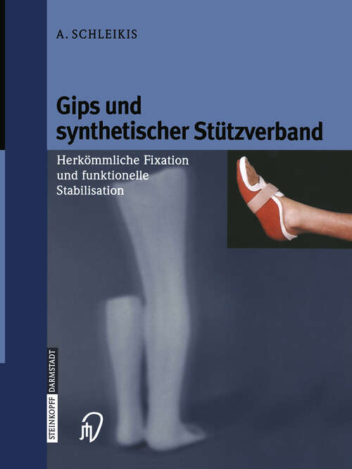 Book cover of Gips und synthetischer Stützverband: Herkömmliche Fixation und funktionelle Stabilisation (2000)