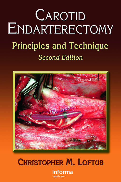 Book cover of Carotid Endarterectomy: Principles and Technique (2)