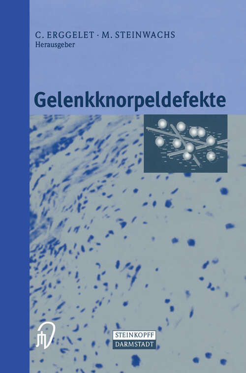 Book cover of Gelenkknorpeldefekte (2001)