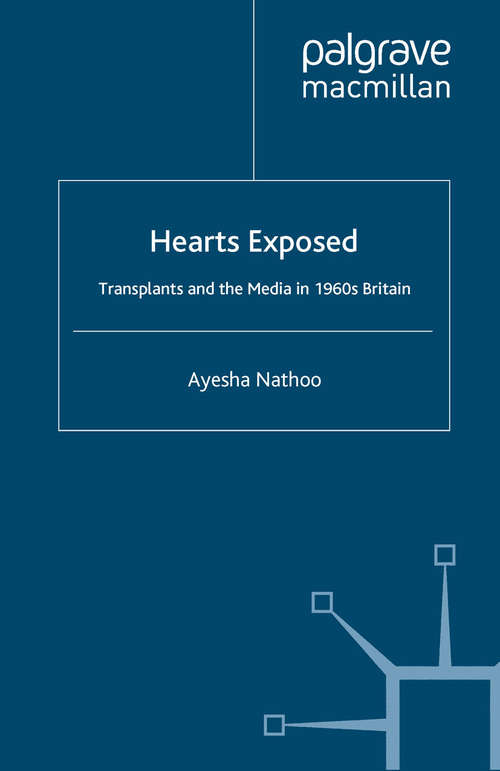 Book cover of Hearts Exposed: Transplants and the Media in 1960s Britain (2009) (Science, Technology and Medicine in Modern History)