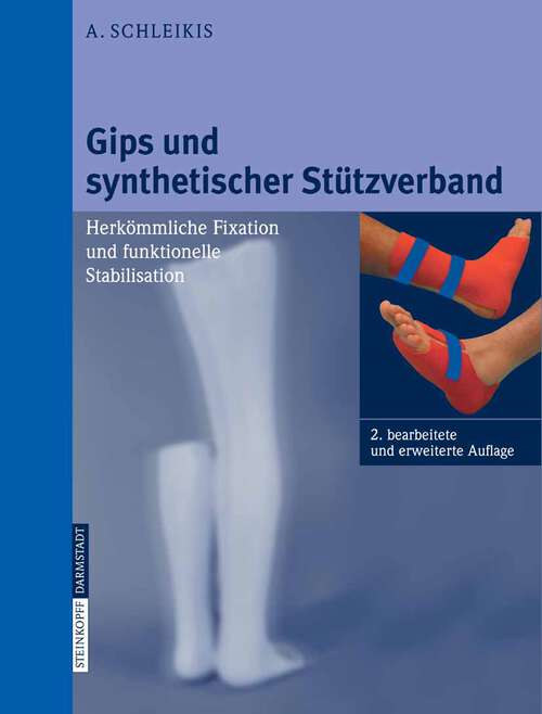 Book cover of Gips und synthetischer Stützverband: Herkömmliche Fixation und funktionelle Stabilisation (2., bearb. und erw. Aufl. 2007)