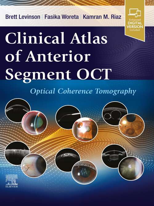 Book cover of Clinical Atlas of Anterior Segment OCT: Optical Coherence Tomography