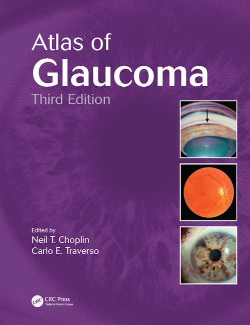 Book cover of Atlas of Glaucoma (3)