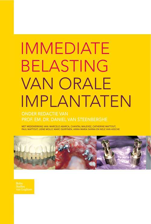 Book cover of Immediate belasting van orale implantaten (2008)