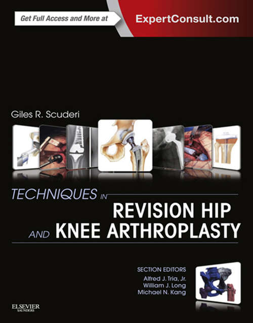 Book cover of Techniques in Revision Hip and Knee Arthroplasty E-Book: Expert Consult