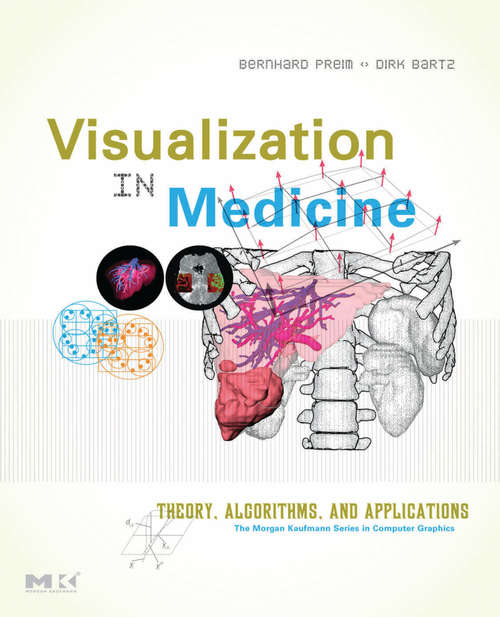 Book cover of Visualization in Medicine: Theory, Algorithms, and Applications (The Morgan Kaufmann Series in Computer Graphics)