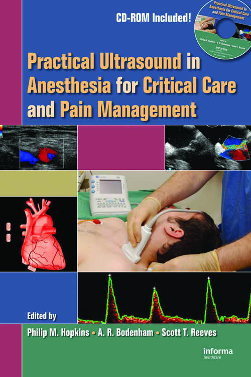 Book cover of Practical Ultrasound in Anesthesia for Critical Care and Pain Management
