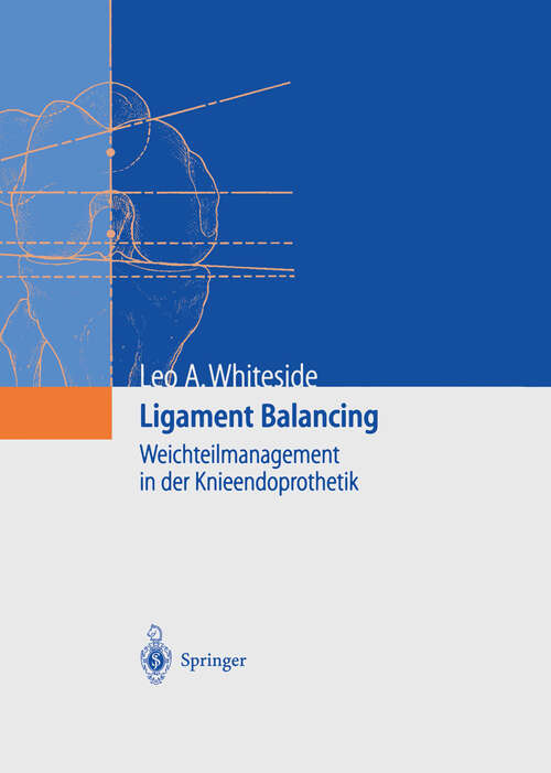 Book cover of Ligament Balancing: Weichteilmanagement in der Knieendoprothetik (2004)