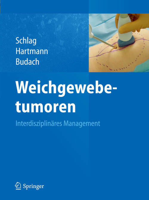 Book cover of Weichgewebetumoren: Interdisziplinäres Management (2011)