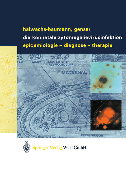 Book cover of Die konnatale Zytomegalievirusinfektion: Epidemiologie - Diagnose - Therapie (2003)
