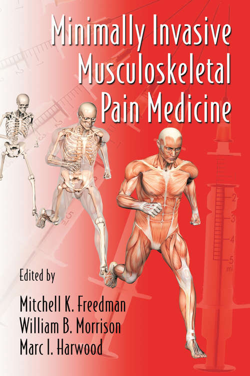 Book cover of Minimally Invasive Musculoskeletal Pain Medicine