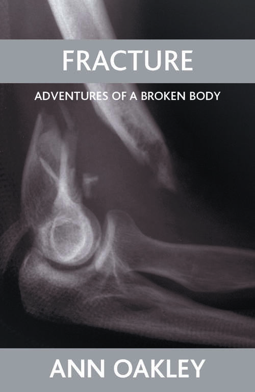 Book cover of Fracture: Adventures of a broken body