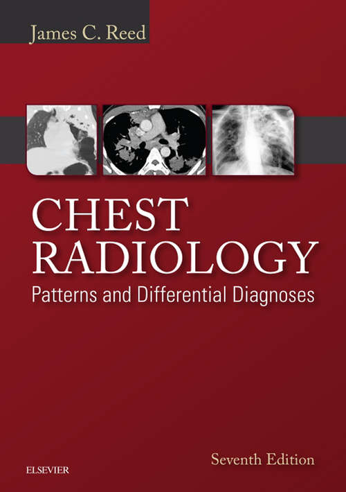 Book cover of Chest Radiology: Patterns And Differential Diagnoses (7)