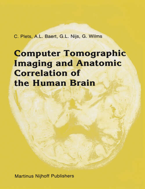 Book cover of Computer Tomographic Imaging and Anatomic Correlation of the Human Brain: A comparative atlas of thin CT-scan sections and correlated neuro-anatomic preparations (1987) (Series in Radiology #13)