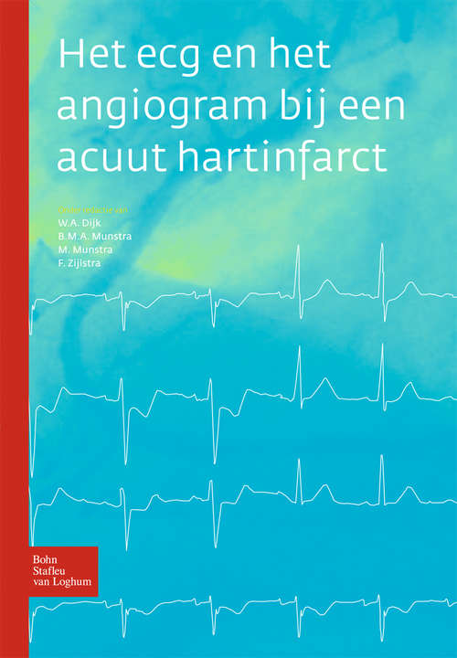 Book cover of Het ecg en het angiogram bij een acuut hartinfarct (2010)