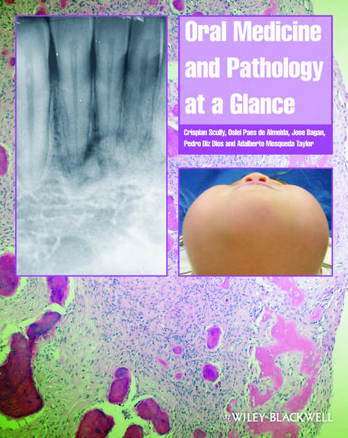 Book cover of Oral Medicine and Pathology at a Glance (2) (At a Glance (Dentistry))