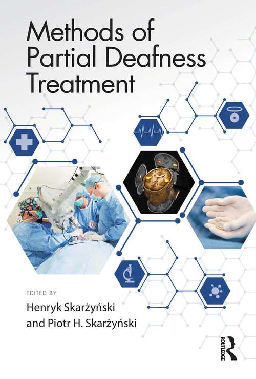 Book cover of Methods of Partial Deafness Treatment