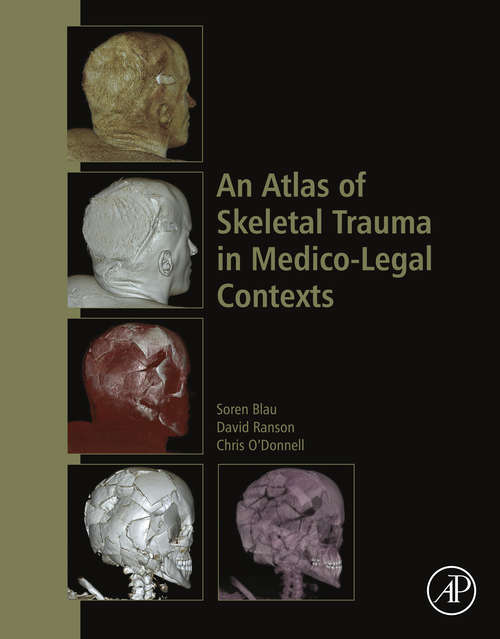 Book cover of An Atlas of Skeletal Trauma in Medico-Legal Contexts