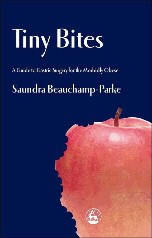 Book cover of Tiny Bites: A Guide to Gastric Surgery for the Morbidly Obese (PDF)