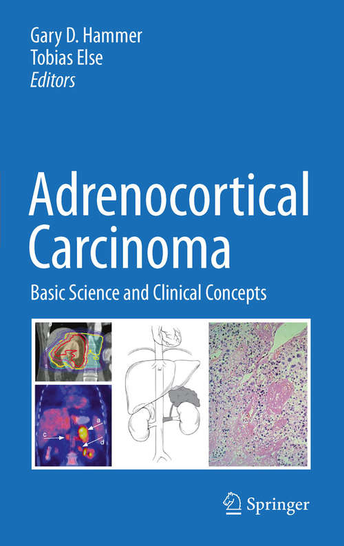 Book cover of Adrenocortical Carcinoma: Basic Science and Clinical Concepts (2011)