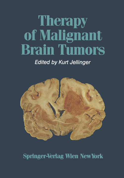 Book cover of Therapy of Malignant Brain Tumors (1987)