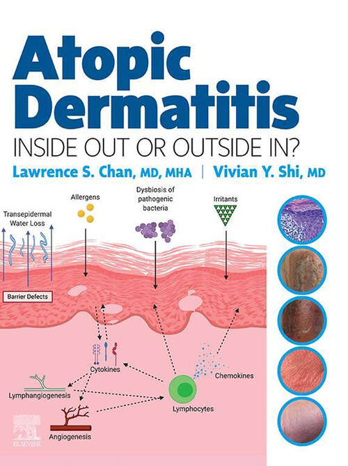 Book cover of Atopic Dermatitis: Inside Out or Outside In - E-Book