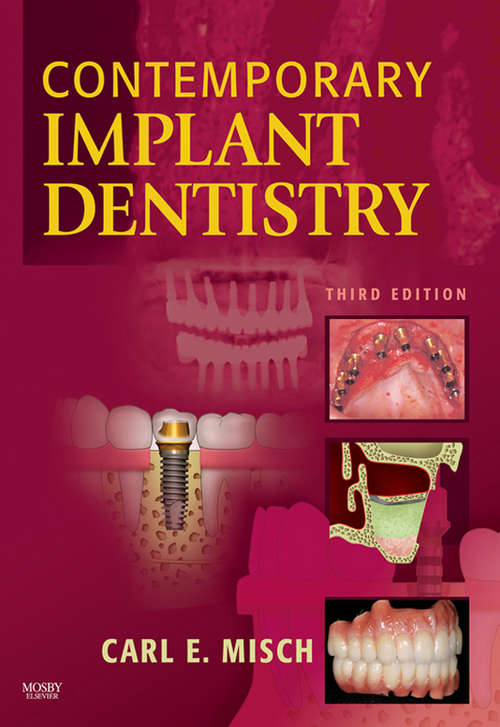 Book cover of Contemporary Implant Dentistry - E-Book (2)
