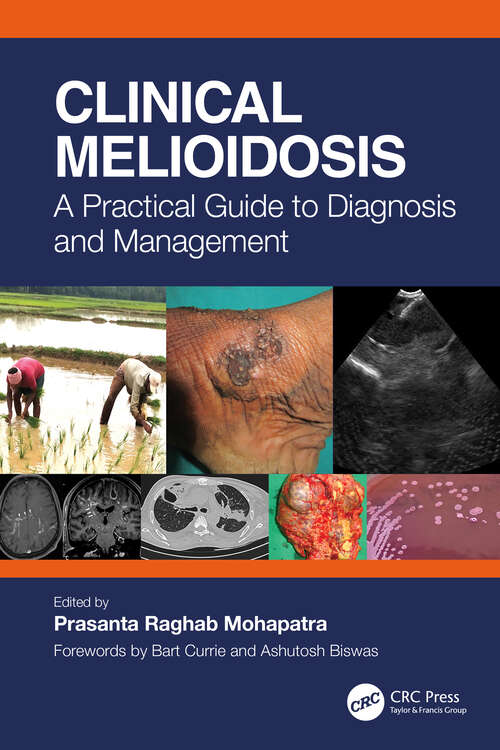 Book cover of Clinical Melioidosis: A Practical Guide to Diagnosis and Management