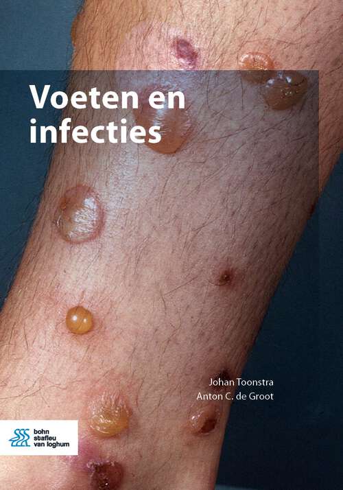 Book cover of Voeten en infecties (1st ed. 2023)