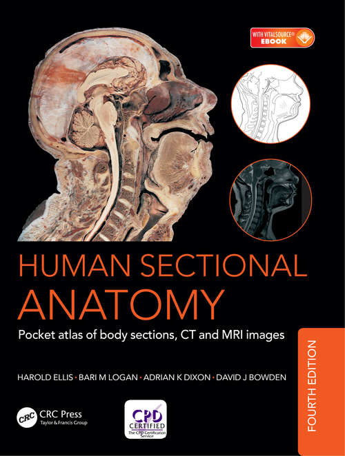 Book cover of Human Sectional Anatomy: Pocket atlas of body sections, CT and MRI images, Fourth edition