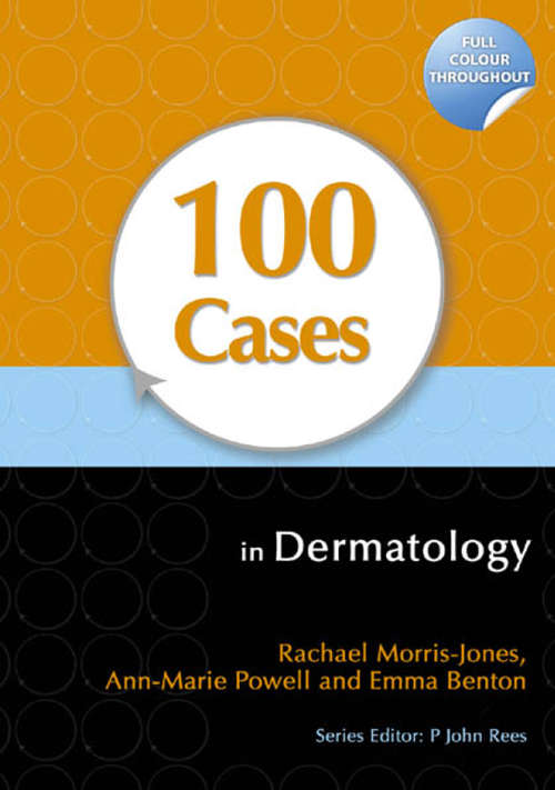 Book cover of 100 Cases in Dermatology