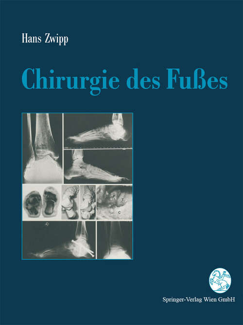 Book cover of Chirurgie des Fußes (1994)