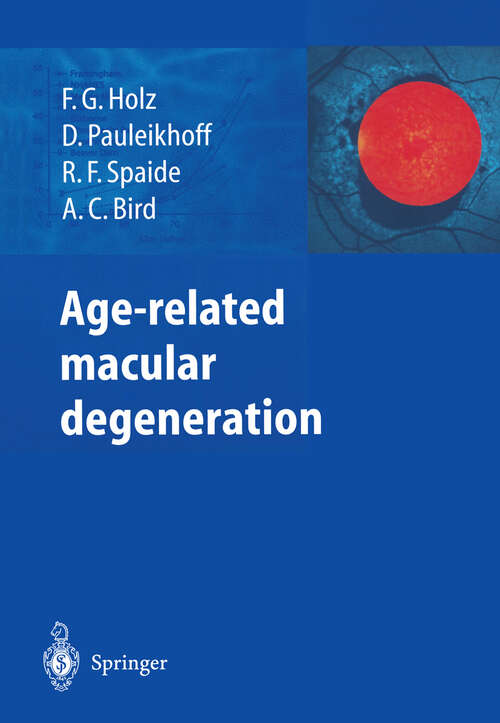Book cover of Age-related macular degeneration (2004)