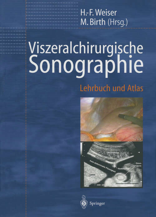 Book cover of Viszeralchirurgische Sonographie: Lehrbuch und Atlas (2000)