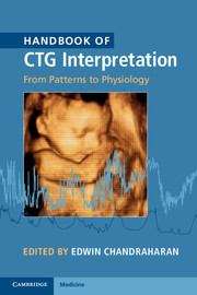 Book cover of Handbook Of Ctg Interpretation: From Patterns To Physiology (PDF)