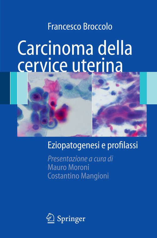 Book cover of Carcinoma della cervice uterina: Eziopatogenesi e profilassi (2008)