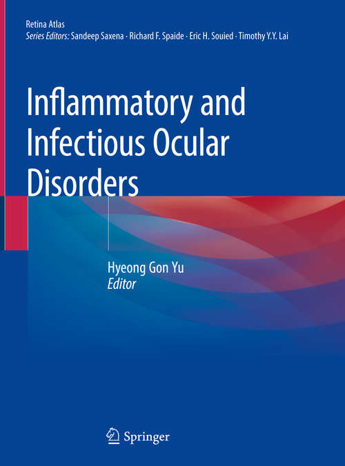 Book cover of Inflammatory and Infectious Ocular Disorders (1st ed. 2020) (Retina Atlas)