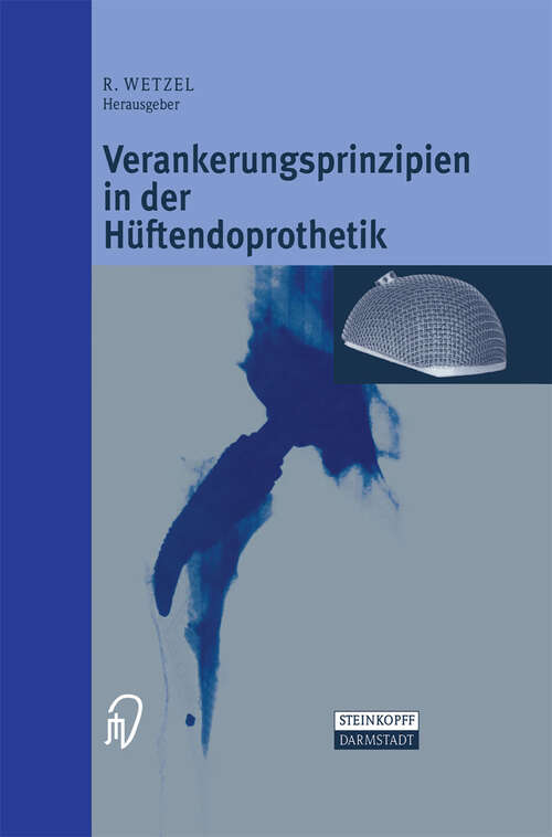 Book cover of Verankerungsprinzipien in der Hüftendoprothetik (2001)