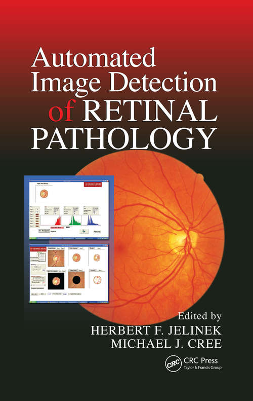 Book cover of Automated Image Detection of Retinal Pathology