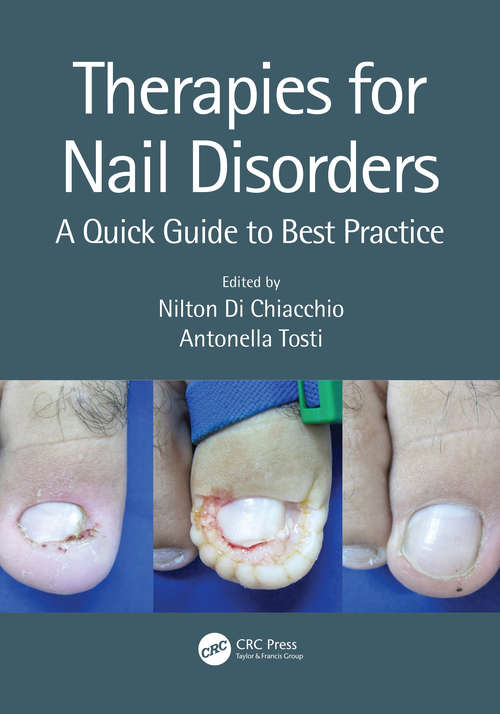 Book cover of Therapies for Nail Disorders: A Quick Guide to Best Practice